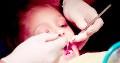 Dentist working with a patient